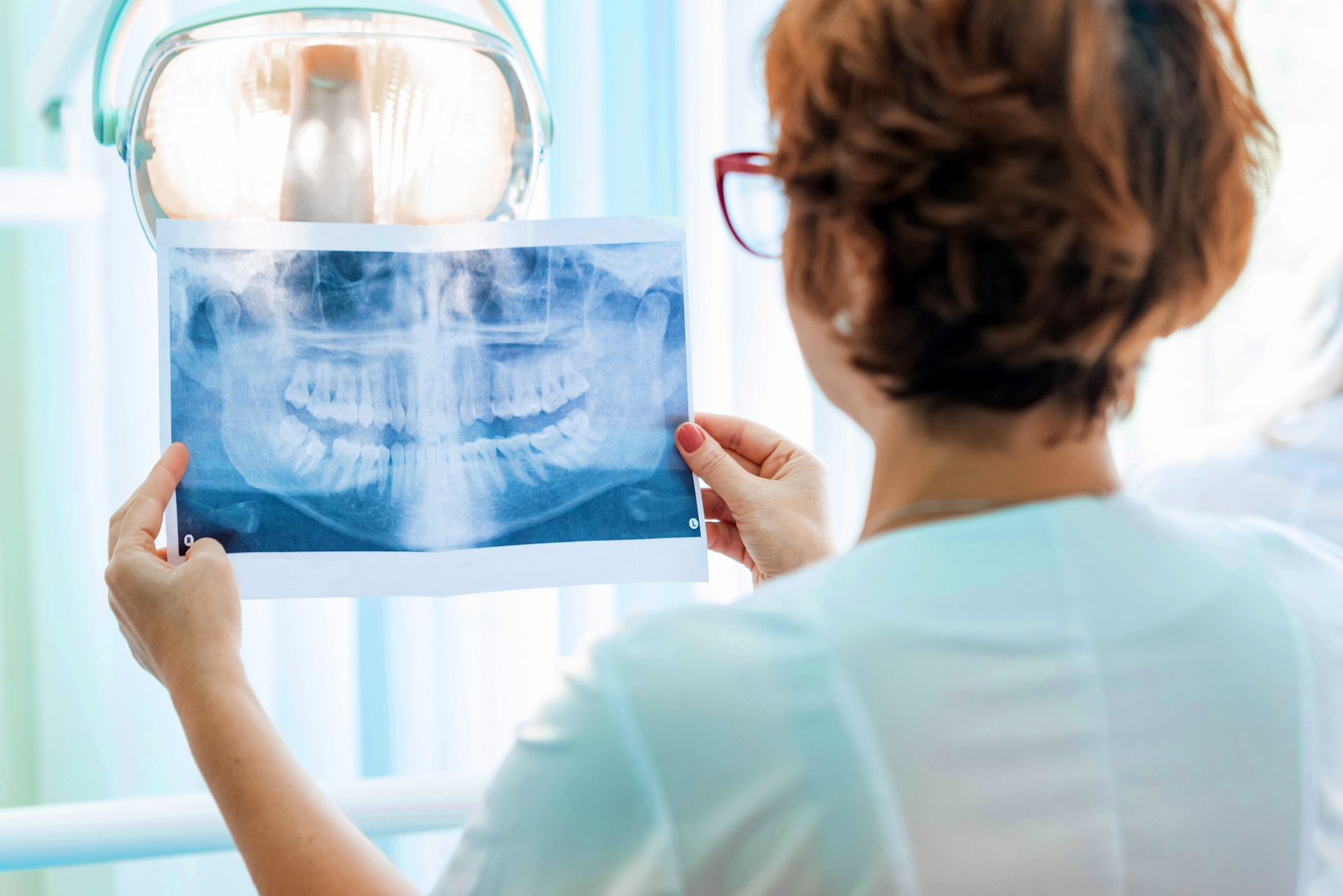 Jak wygląda rentgen zęba?
